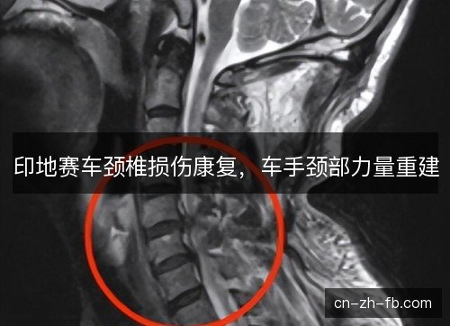 印地赛车颈椎损伤康复，车手颈部力量重建